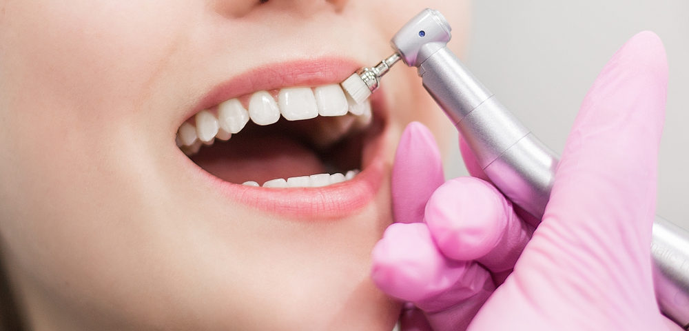 Qué es la limpieza dental con ultrasonidos?