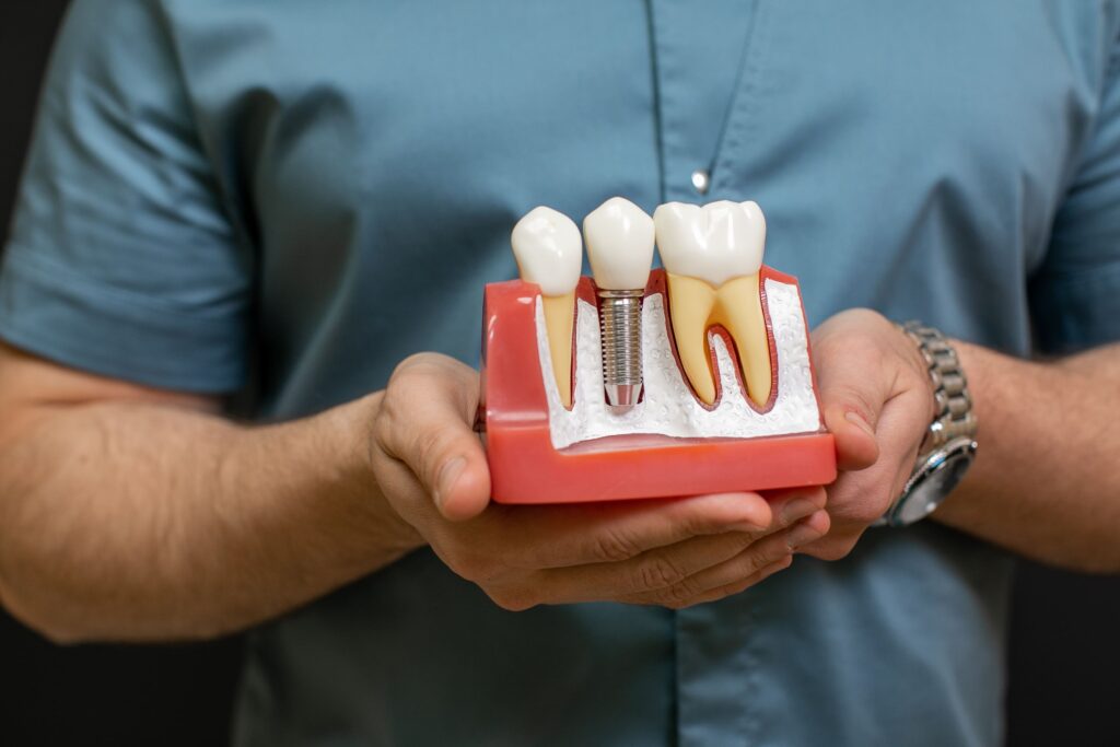 Dentista enseñando una maqueta de una dentadura con implante dental