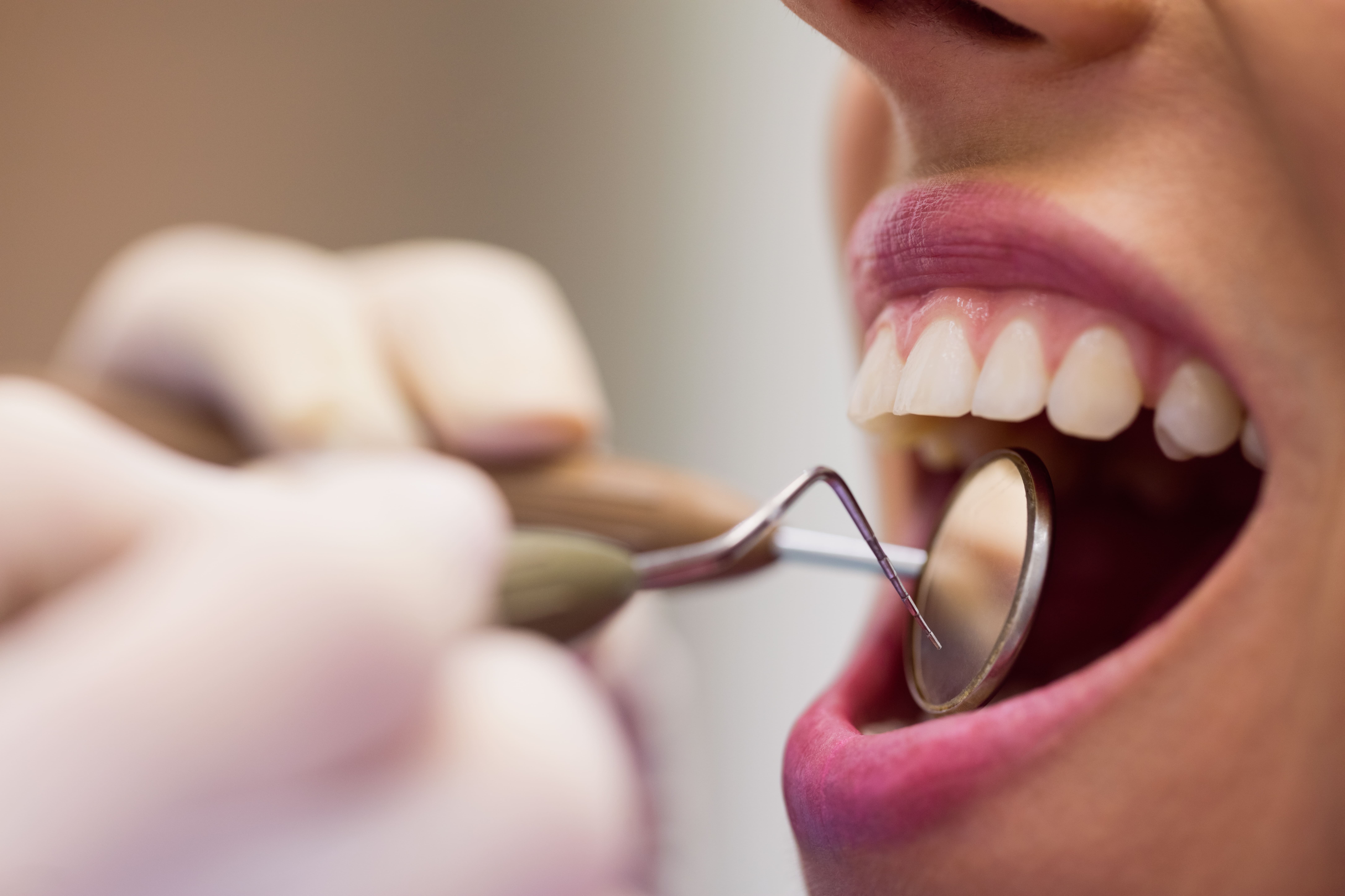 "Tratamiento de periodoncia en Murcia: odontólogo especializado examinando encías y tejido periodontal