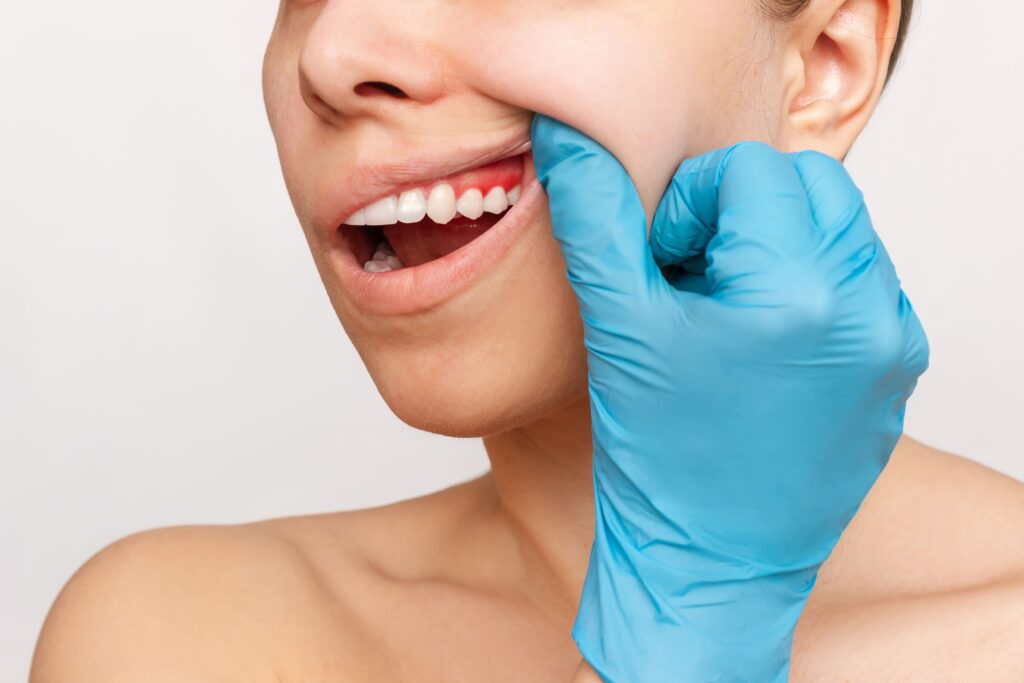 "Paciente señalando sus encías enrojecidas, indicando signos de inflamación y posible enfermedad periodontal.